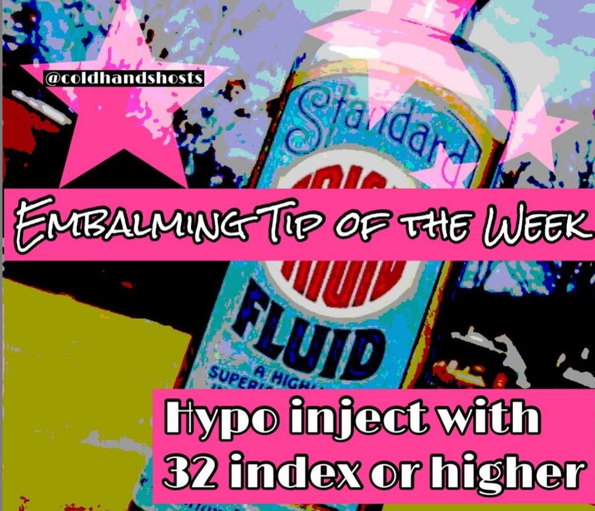 cold-hands-embalming-tip-of-the-week-laptrinhx-news